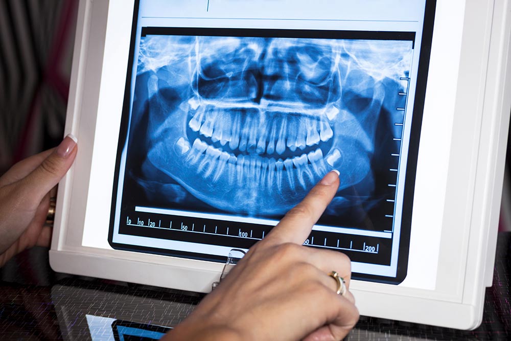 Dr. Anwar Adhan - Ideal Dentistry | Dentist in Sacramento
